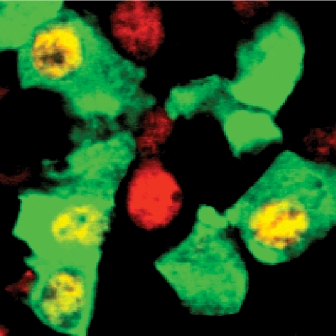 A pancreas containing two populations of cells. The red cells synthesize microRNAs while the green ones don’t. Image from the lab of Dr. Eran Hornstein